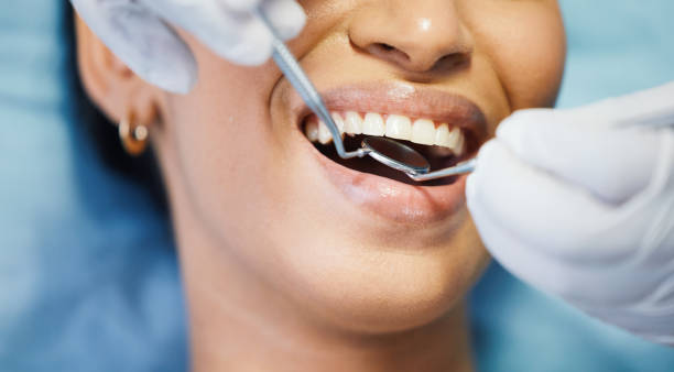 Best Emergency Dentist for Knocked-Out Tooth in Shandon, CA